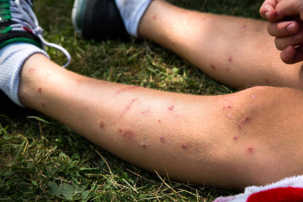 mosquito tigre en Bizkaia